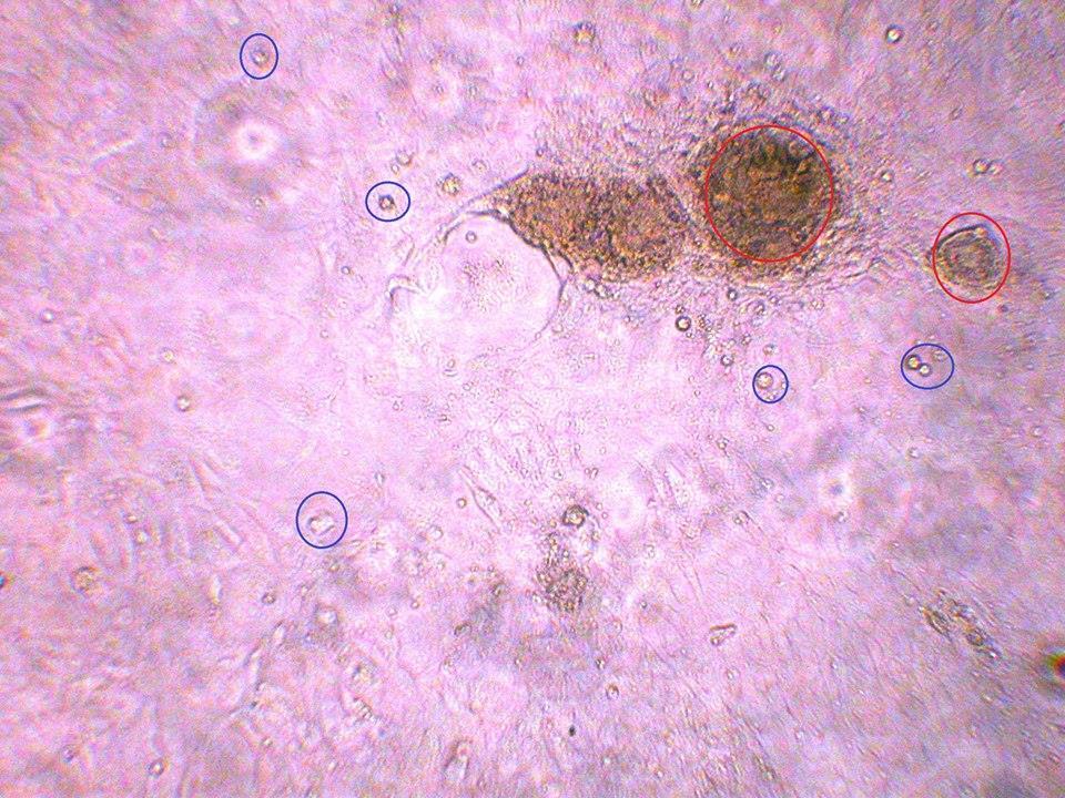 herpesviru na buněčných liniích není vždy úspěšná, proto negativní výsledky kultivace nejsou z hlediska diagnostiky považovány za signifikantní. Obrázek č.