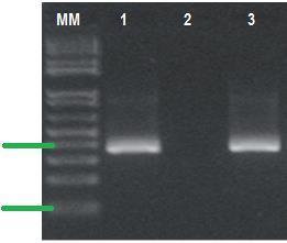 vzorek, velikost finálního amplikonu = (409 bp) (podle Novotný a kol., 2010). 400 bp 100 bp Obr. 8. Nested PCR - vnitřní primery podle D.