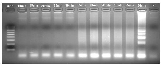 Obr. 9. Agarózový gel, který ukazuje časový průběh amplifikace KHV DNA pomocí LAMP testu. Test se provádí při teplotě 65 C po dobu trvání 10-