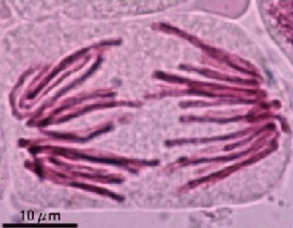 anafáze Anafáze začíná degradací proteinů (kohezinů), které drží dvě sesterské chromatidy do tohoto