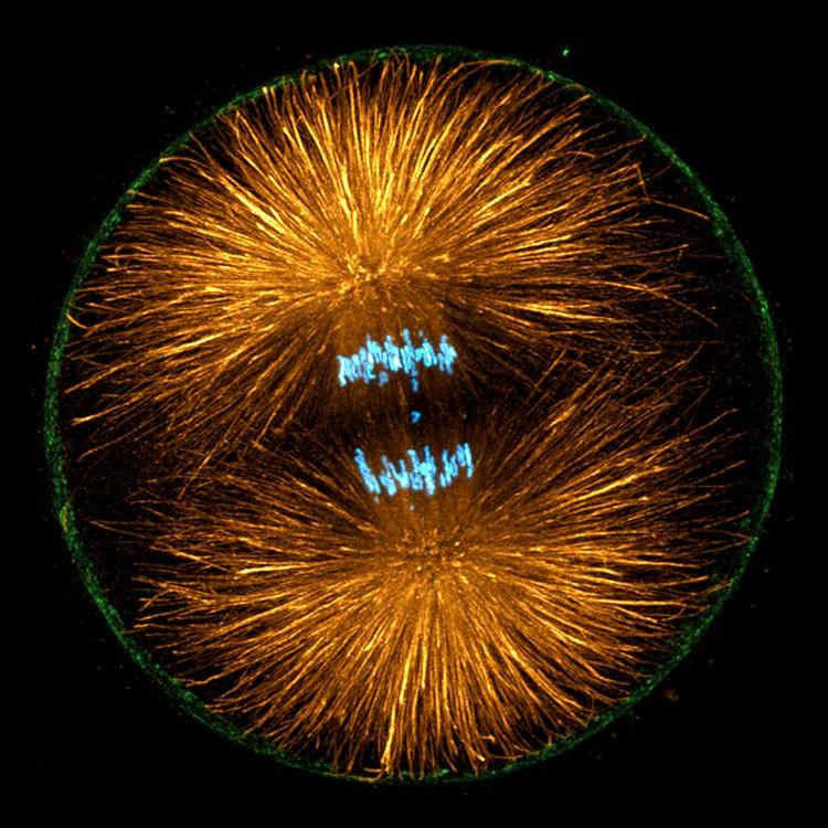 George Po von Dassow, University of Oregon vstupu do anaphase, vřeténko reorganizuje dramaticky: kinetochore vlákna spojená s chromozomy zkrátit, čímž chromatidy směrem k pólům.