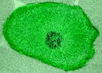 kondenzace chromozomů mizí jadérko (nucleolus), které je organizováno sekundárními konstrikcemi chromozomů a