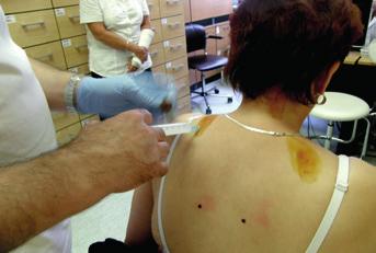 Malé intervence se provádí přímo na ambulanci, velké intervence ze zajištěného lůžka na neurochirurgické klinice.