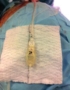 6/18 50 let neurochirurgie v Ústí nad Labem 9.