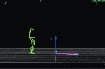 Úspěšně jsme jako první v ČR zavedli do praxe aplikaci personalizovaných tyčí vyráběných dle předoperační digitální simulace vlastní operační 3D korekce deformity páteře pro každého pacienta