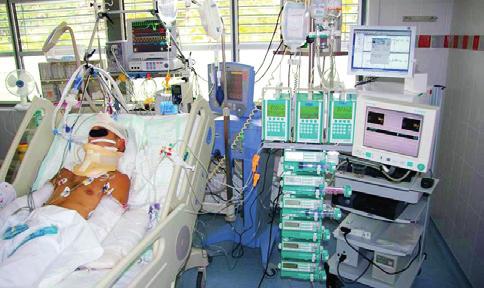 Jsme vybaveni jak standardními monitory k měření intrakraniálního tlaku, tak i přístroji k měření mozkové oxygenace (Licox, Raumedic), průtoku krve mozkem (Hemedex) a především pak mikrodialýzou,