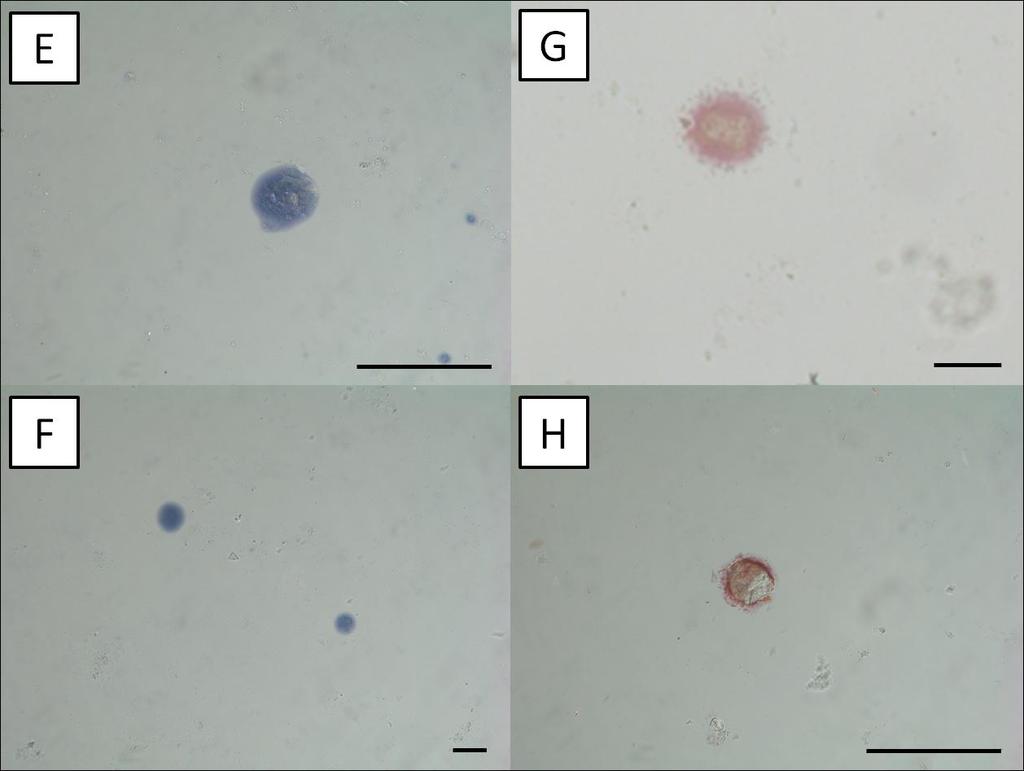 Obrázek 13.: Imunolokalizace lysozymu v exkrementech Lepidoglyphus destructor.