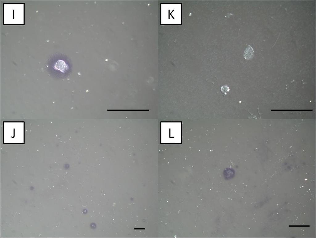 Obrázek 14.: Imunolokalizace lysozymu v exkrementech Dermatophagoides pteronyssinus.