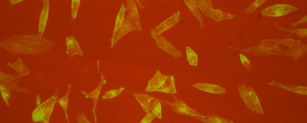 Abychom zjistili, jestli se změní schopnost extracelulární proteolýzy po indukci améboidně-mezenchymálního přechodu inhibitorem Y27632, provedli jsme pokus se sklíčky pokrytými želatinem konjugovaným
