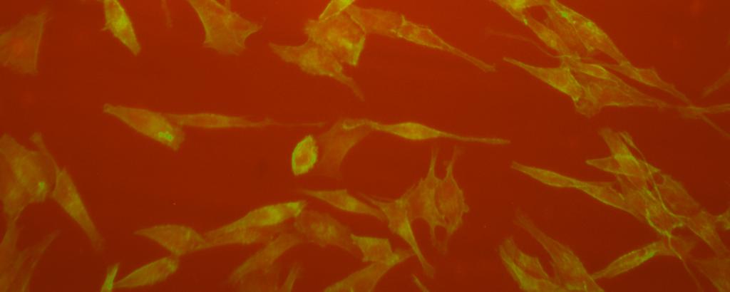 Na sklíčka jsme vyseli buňky na konečnou 20% konfluenci. A indukovali jsme améboidně-mezenchymální přechod 10 µm inhibitorem Y27632.
