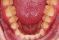 léčby Figure 1: Pre-treatment