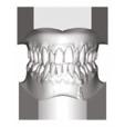 late mandibular growth after the completion of his initial