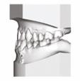 Figure 4A-F: The malocclusion models are shown here: note