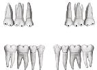DATE 02/02/17 NW ANGLE GUEST CASE REPORT GUEST Riolo, Christopher CASE # 3 9 ABO CAST-RADIOGRAPH EVALUATION INSTRUCTIONS: Second molars should be in occlusion.