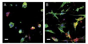 Rhomboid smooth muscle cells were cultured on untreated (A) or plasma treated (B) electrospun polycaprolactone patches.