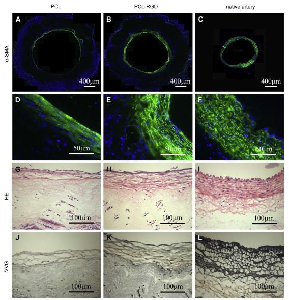 Smooth muscle regeneration and ECM production at 4 weeks after implantation.