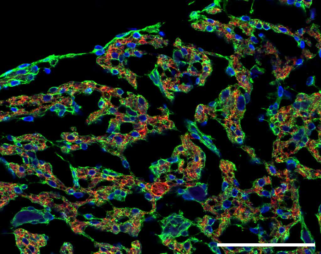 Obrázek 11: Příklady obrázků z konfokálního fluorescenčního mikroskopu po značení
