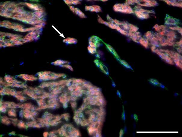 V případě normotermie byl rozdíl ve velikosti signifikantní (párový Studentův t-test, * P < 0,05). Obrázek 12: Ukázka Purkyňových vláken v řezu.