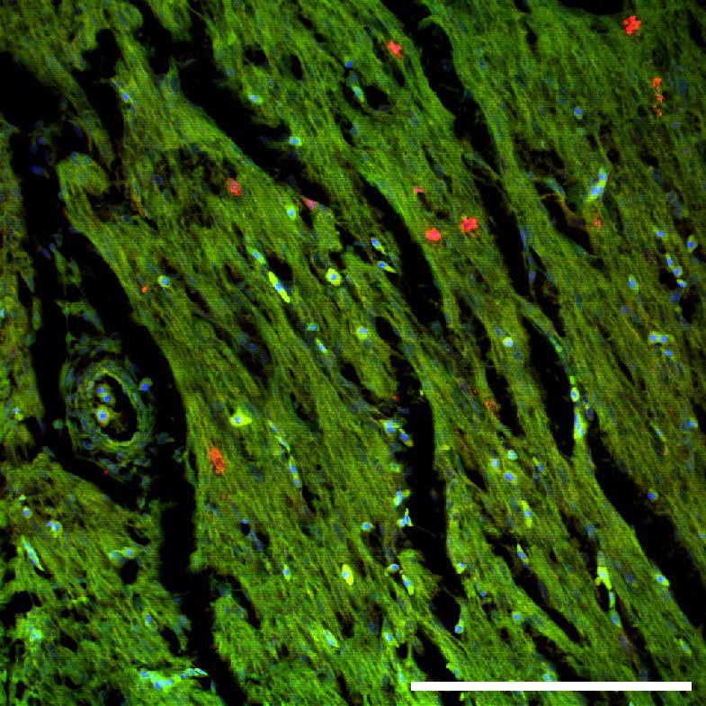Obrázek 13: Příklad snímků z konfokálního fluorescenčního mikroskopu po značení phis