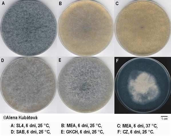 Lichtheimia Fungi, Mucoromycota, Mucoromycotina, Mucorales, Lichtheimiaceae Lichtheimia corymbifera (syn.