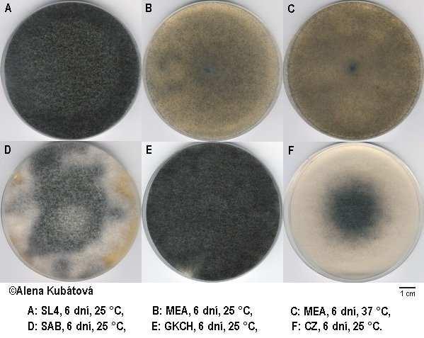 Syncephalastrum Fungi, Mucoromycota, Mucoromycotina, Mucorales, Syncephalastraceae Syncephalastrum racemosum kontaminanta klinického