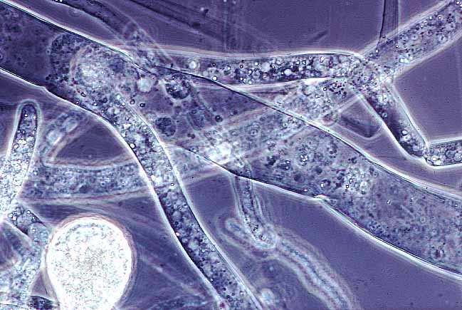 Stélka kokální - jednobuněčná, n nebo 2n (kvasinky (Ascomycota: Saccharomycetales nebo Basidiomycota: Ustilaginales) sensu