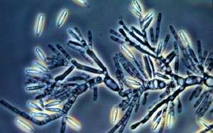 Fylogenyříše Fungi Chytridiomycota Postupná