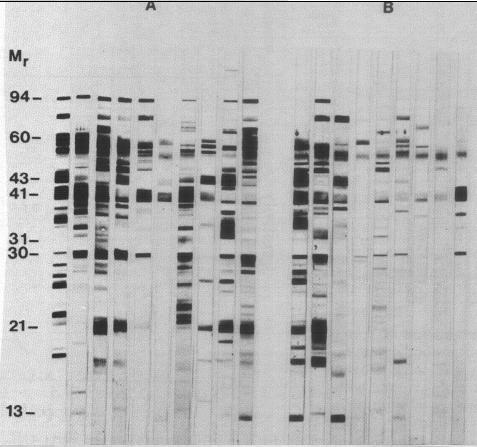 Kmeny borrelií izolované z mozkomíšního moku a z krve s různým obsahem povrchových antigenů.