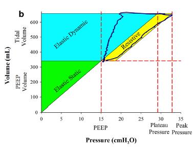 Pohlcená energie na 1 dech cca 0,7 až 0,8 J (ARDS)