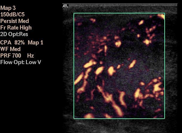 energetický Doppler Color Doppler Energy (CDE), Color Power Angio (CPA), Color Amplitude Imaging (CAI), Color Angiography, Doppler Power Mode, Power Mapping, Amplitude Mapping.