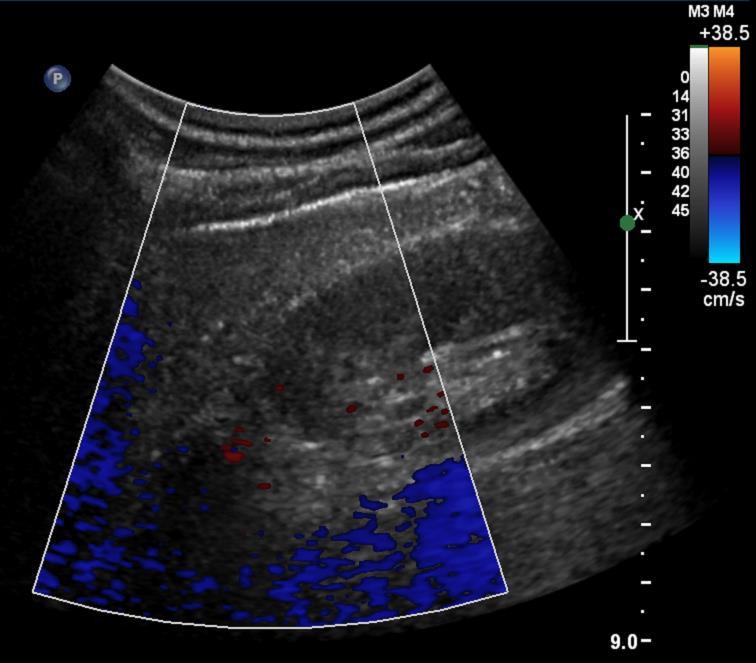 artefakty pohybové srdeční činnost, cévní pulzace, respirace amplituda ~ intenzita frekvence, tj.