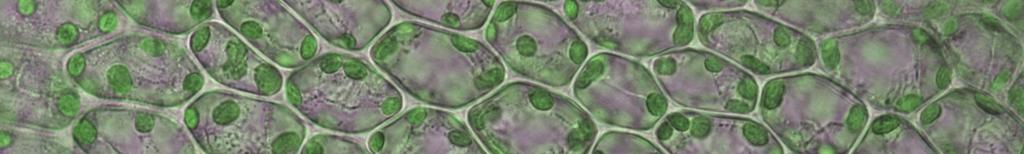 1. Pozorování chloroplastů v buňkách mechu