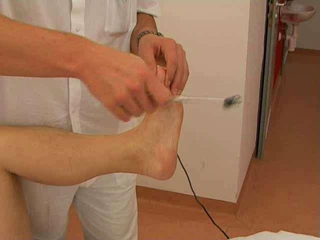 Ztráta inhibice segmentálních míšních reflexů