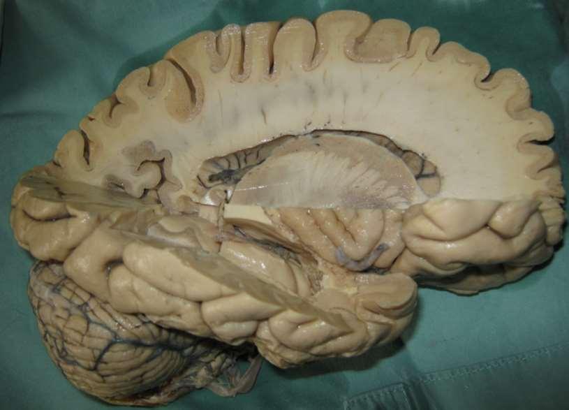 Anatomie