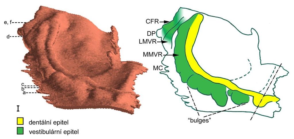 Obrázek 18: Počítačová 3D rekonstrukce dentálního a přilehlého orálního epitelu horní čelisti HU3 a její schematická interpretace: ústní koutek (MC), základ mediálního (MMVR) a laterálního hřebene
