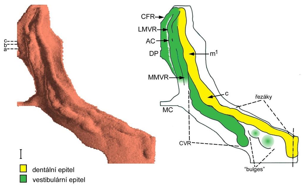 Obrázek 21: Počítačová 3D rekonstrukce dentálního a přilehlého orálního epitelu horní čelisti HU5 a její schematická interpretace: ústní koutek (MC), ductus parotideus (DP), epitel tvářového žlábku