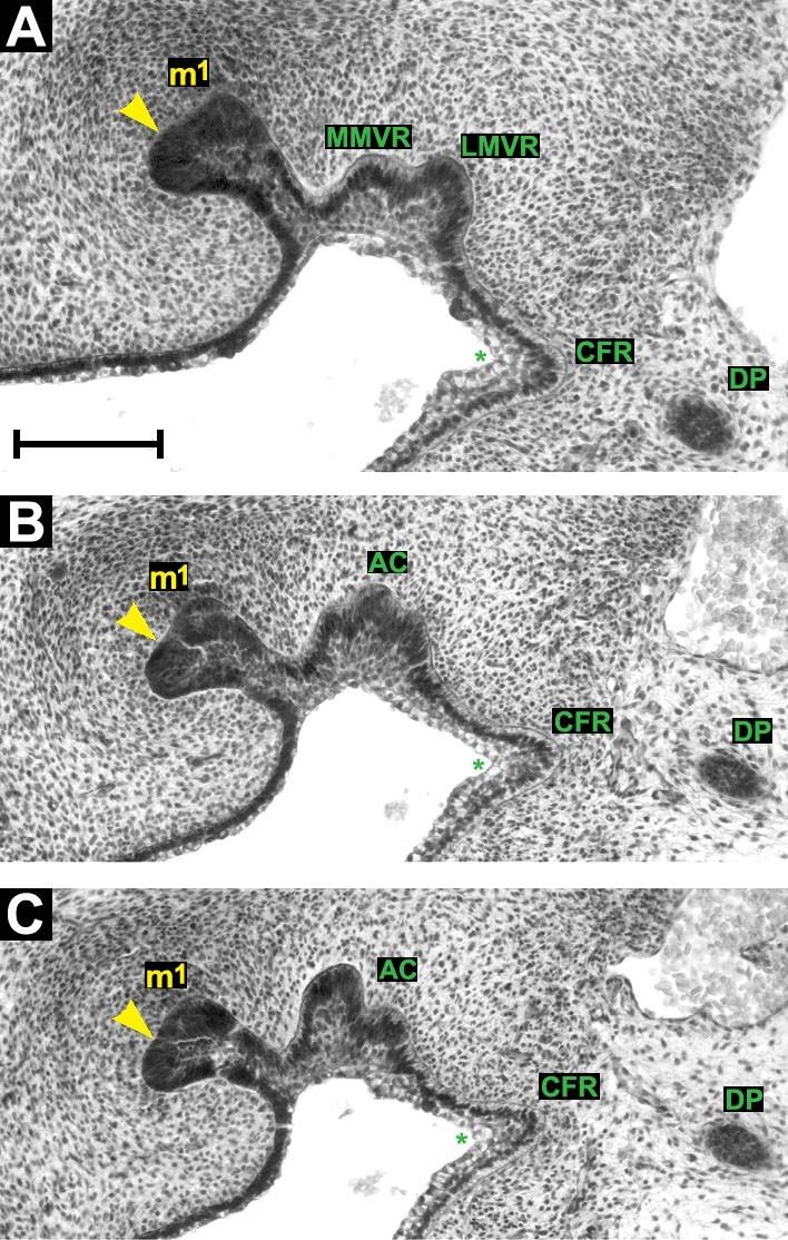Obrázek 22: Frontální histologické řezy zobrazující dentální (žlutě) a přilehlý vestibulární epitel (zeleně) horní čelisti HU5.