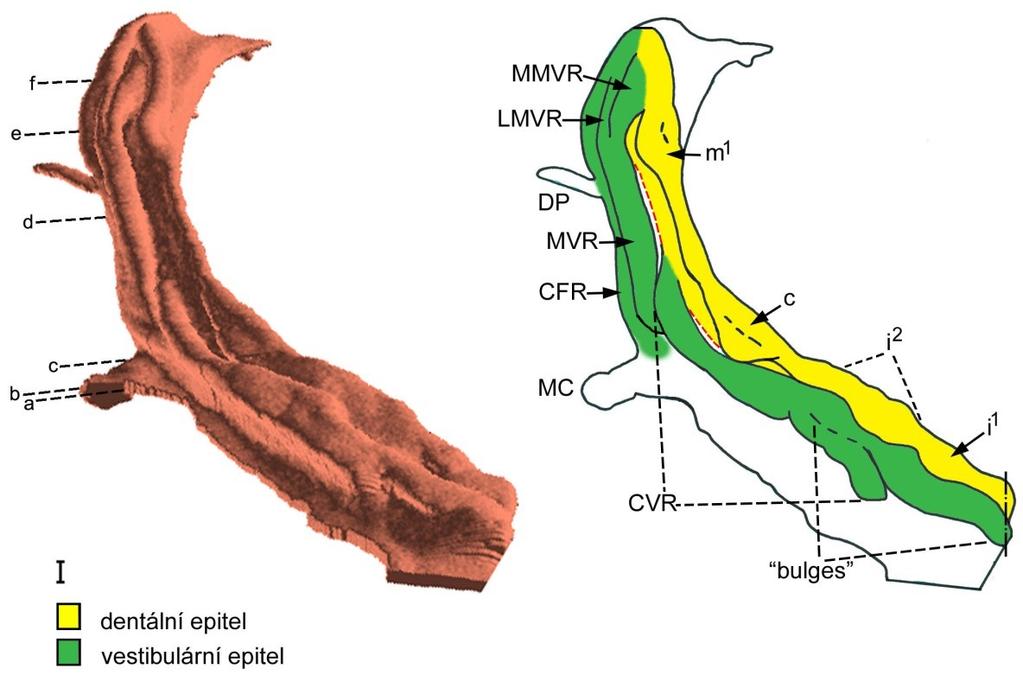 Obrázek 25: Počítačová 3D rekonstrukce dentálního a přilehlého orálního epitelu horní čelisti HU7 a její schematická interpretace: ústní koutek (MC), ductus parotideus (DP), epitel tvářového žlábku