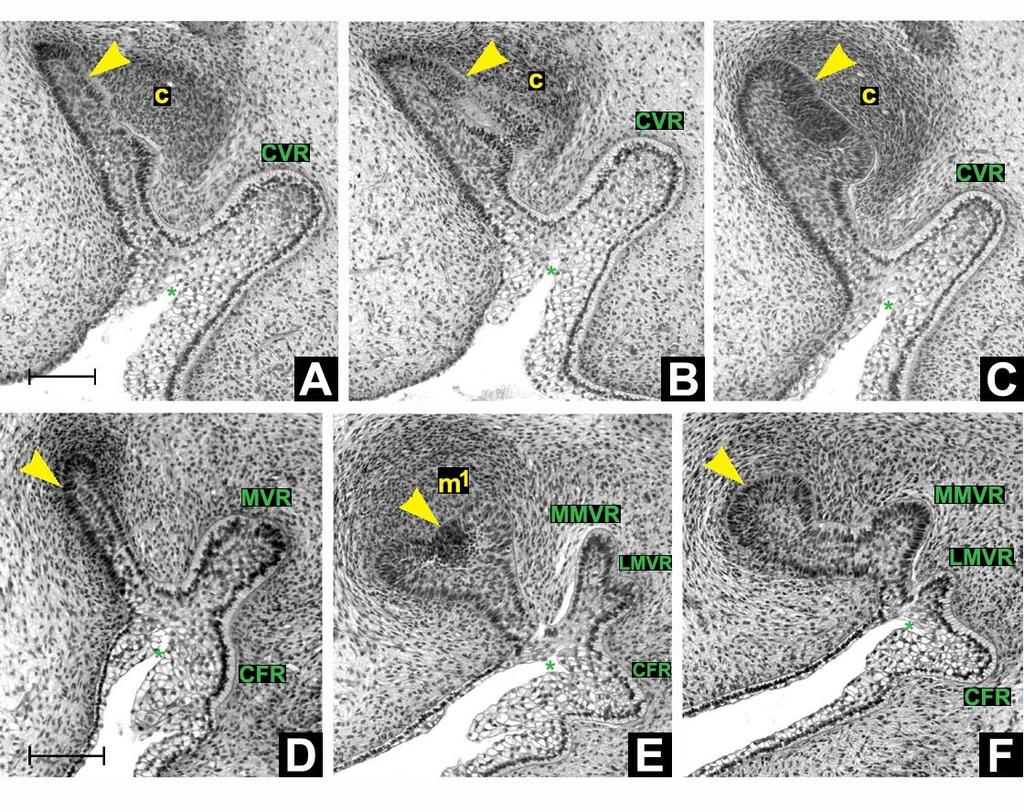 Obrázek 26: Frontální histologické řezy zobrazující dentální (žlutě) a přilehlý vestibulární epitel (zeleně) horní čelisti HU7.