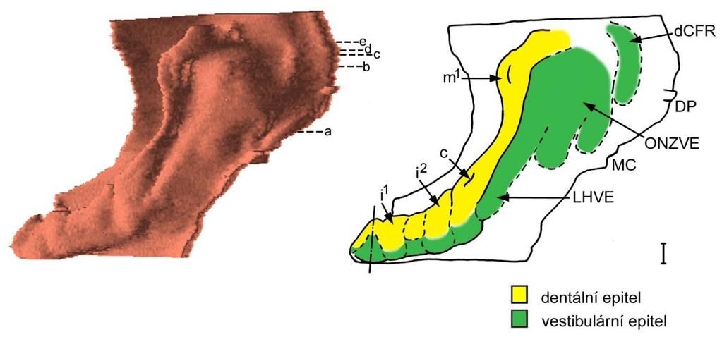 Obrázek 37: Počítačová 3D rekonstrukce dentálního a přilehlého orálního epitelu dolní čelisti HU10 a její schematická interpretace.