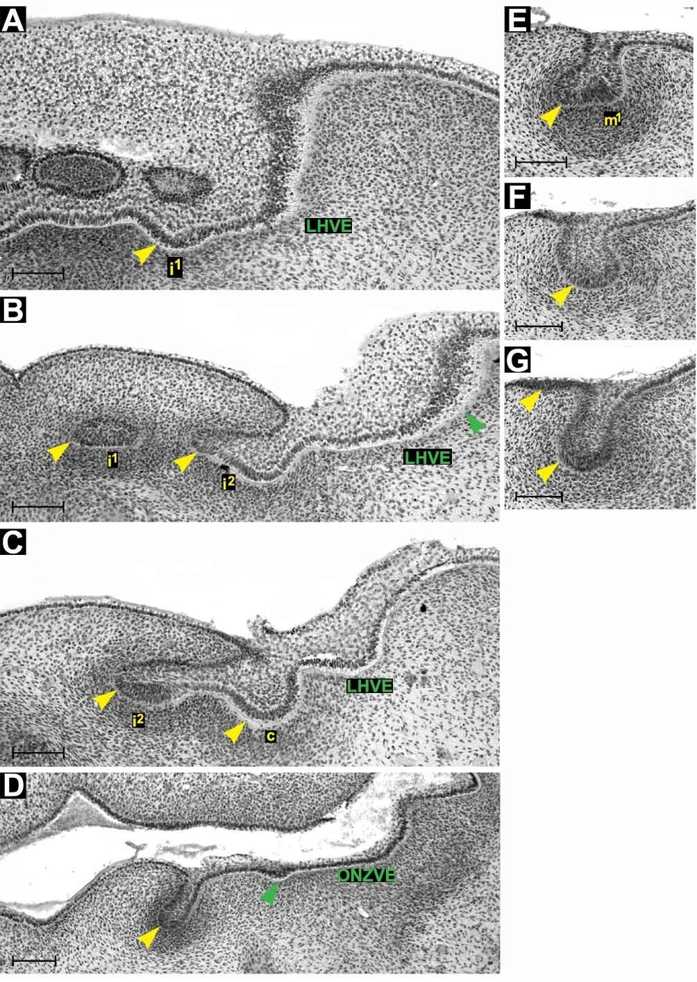 Obrázek 41: Frontální histologické řezy zobrazující dentální (žlutě) a přilehlý vestibulární epitel (zeleně) dolní čelisti HU11.