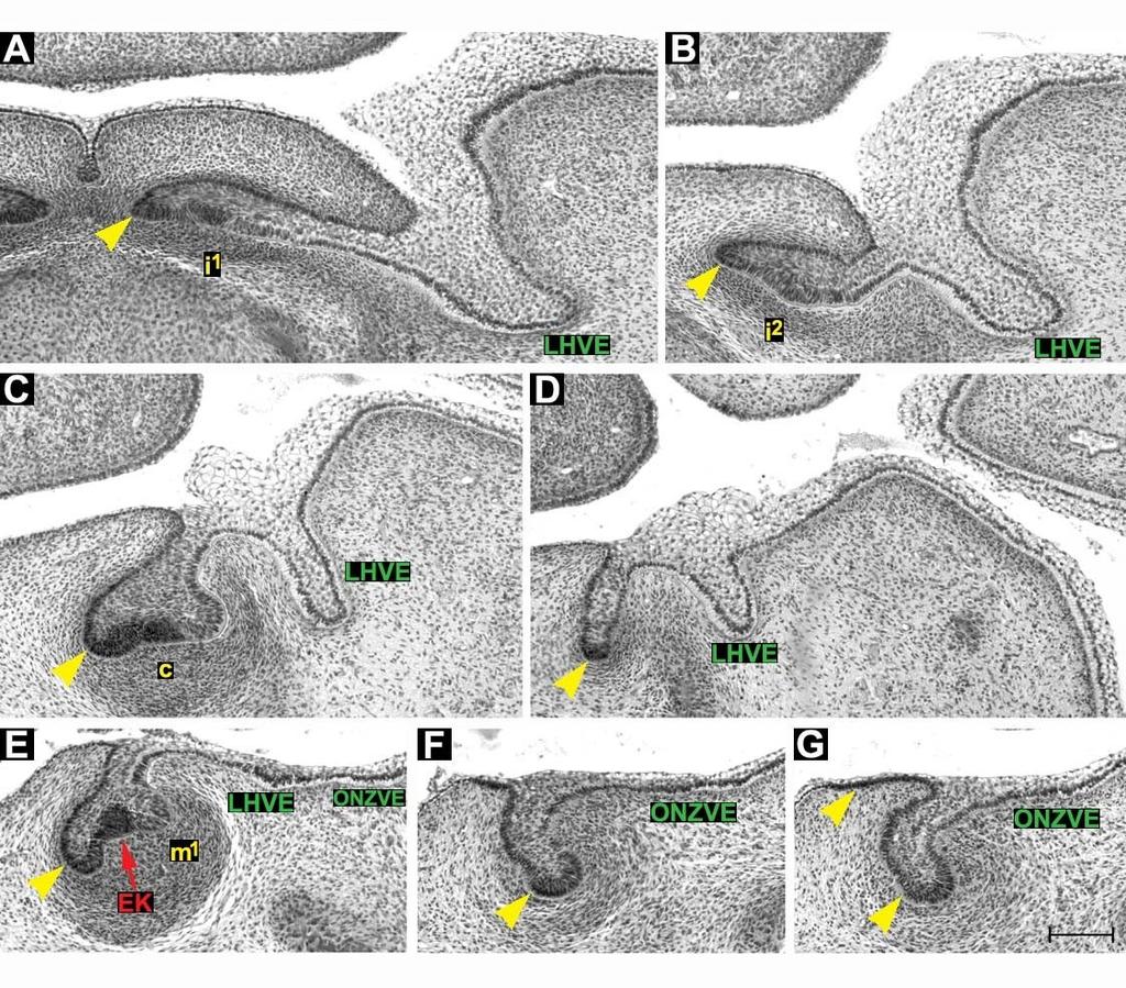 Obrázek 45: Frontální histologické řezy zobrazující dentální (žlutě) a přilehlý vestibulární epitel (zeleně) dolní čelisti HU7.