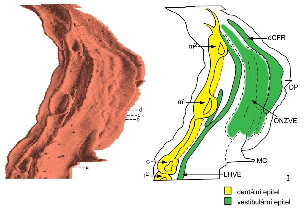 Obrázek 46: Počítačová 3D rekonstrukce dentálního a přilehlého orálního epitelu dolní čelisti HU8 a její schematická interpretace.