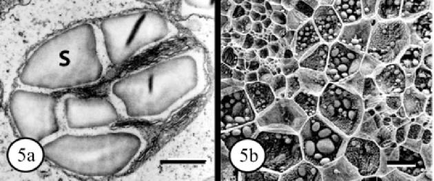 Plastidy vyšších rostlin mají také další funkce Amyloplasty: V buňkách semen, hlíz, plodů, stonků a lodyh