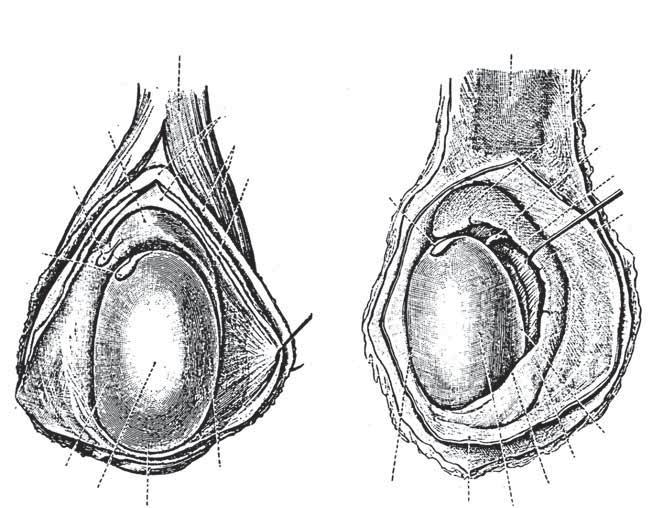 ? caput epididymidis appendix epididymidis (var.