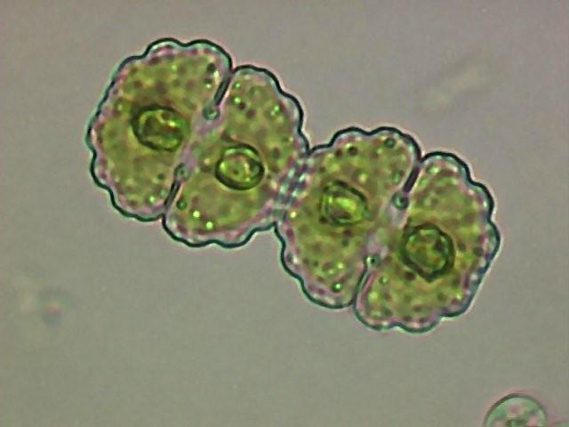 Odd.: Charophyta Třída: Zygnematophyceae Řád: Desmidiales mateřská polovice buňky