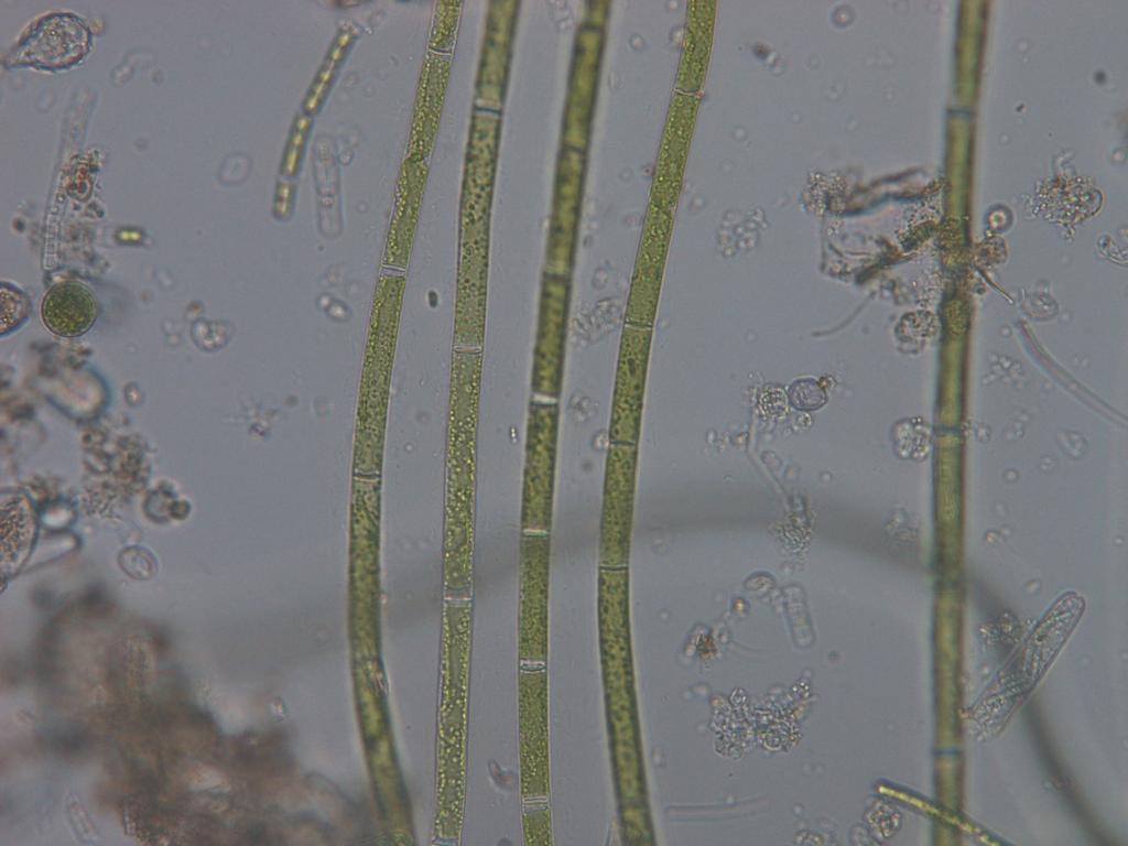 Odd.: Charophyta Třída: Zygnematophyceae