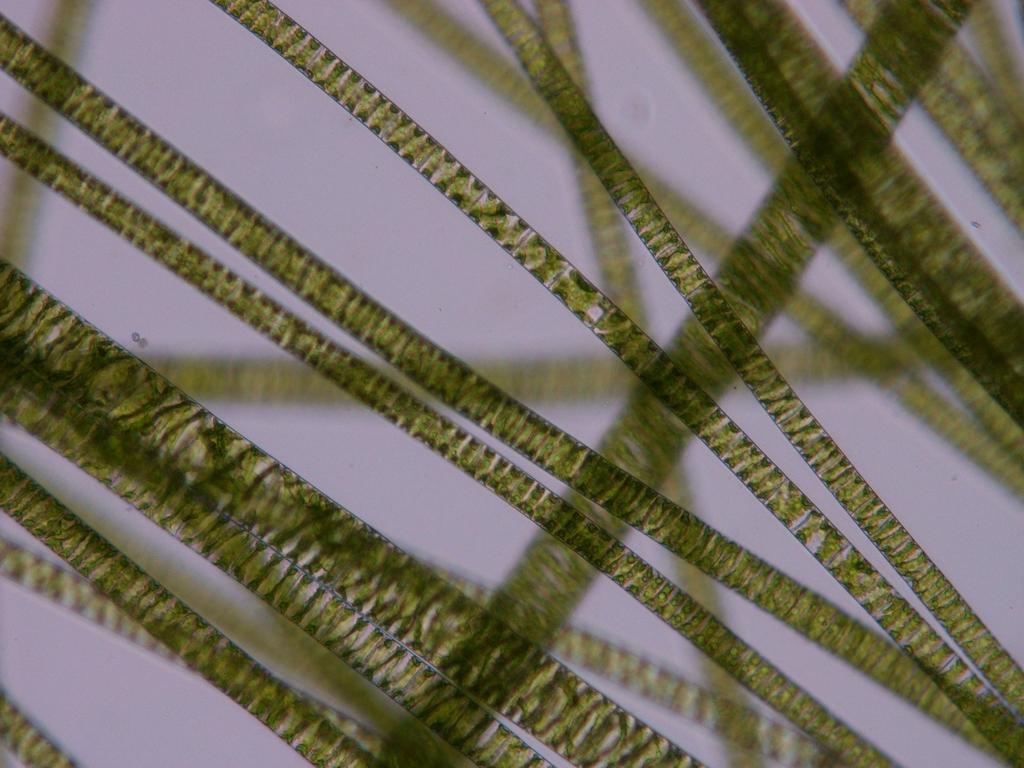 Odd.: Charophyta Třída: Zygnematophyceae