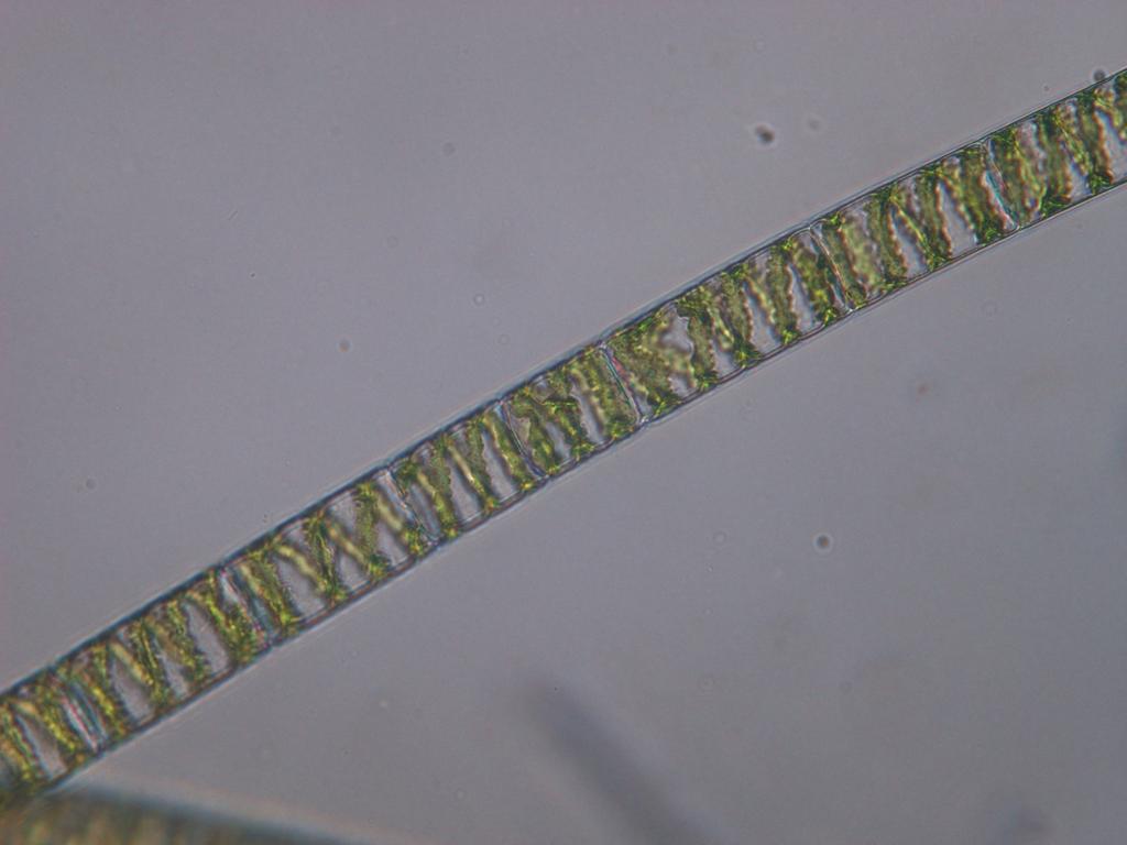 Spirogyra sp.