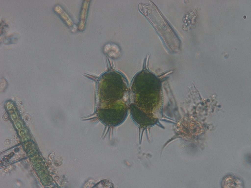 Odd.: Charophyta Třída: Zygnematophyceae